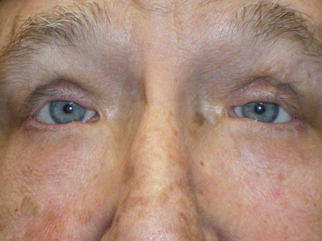 Miscellaneous Case 199 After Photo Miscellaneous