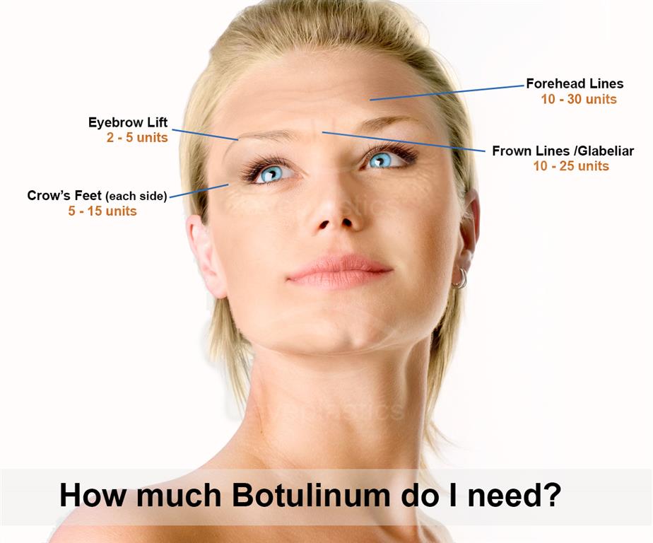 Botox/Dysport - Botulinum Procedure