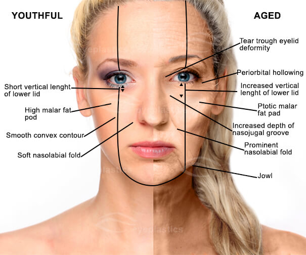 Lower Facelift Boise | Neck Contouring Idaho