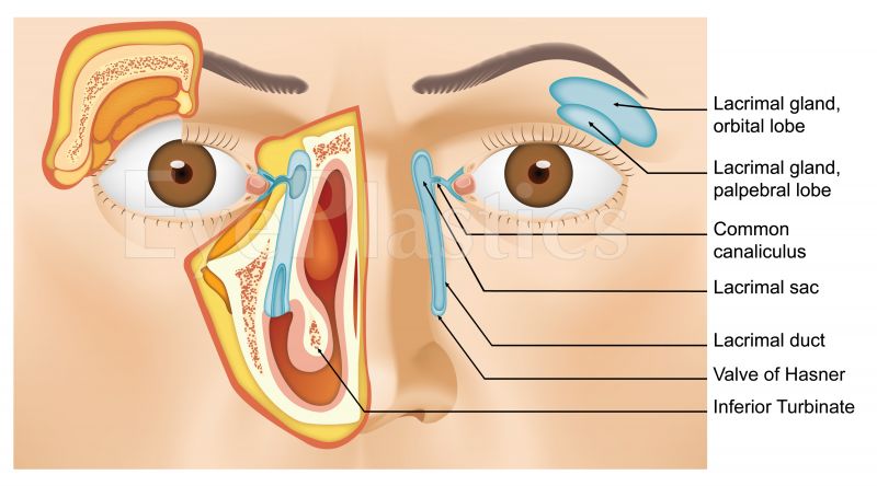 Lacrimal System Boise | Nasolacrimal Duct Obstruction Idaho