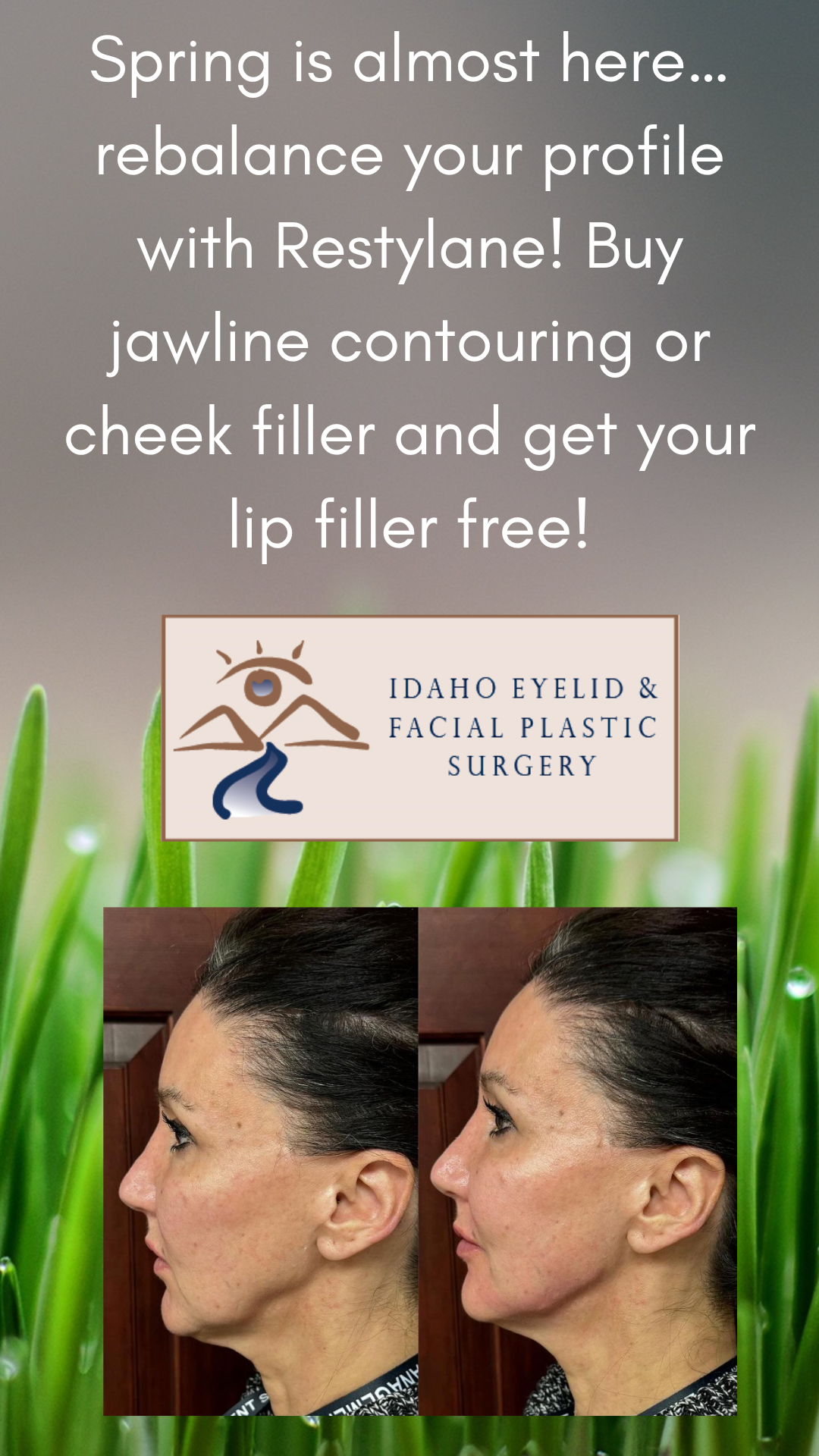 Ophthalmology Specials Boise Events Idaho Facial Plastic Surgery