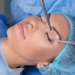 Eyelid Surgery Recovery Timeline: What To Expect Week By Week 1 Upper eyelid blepharoplasty