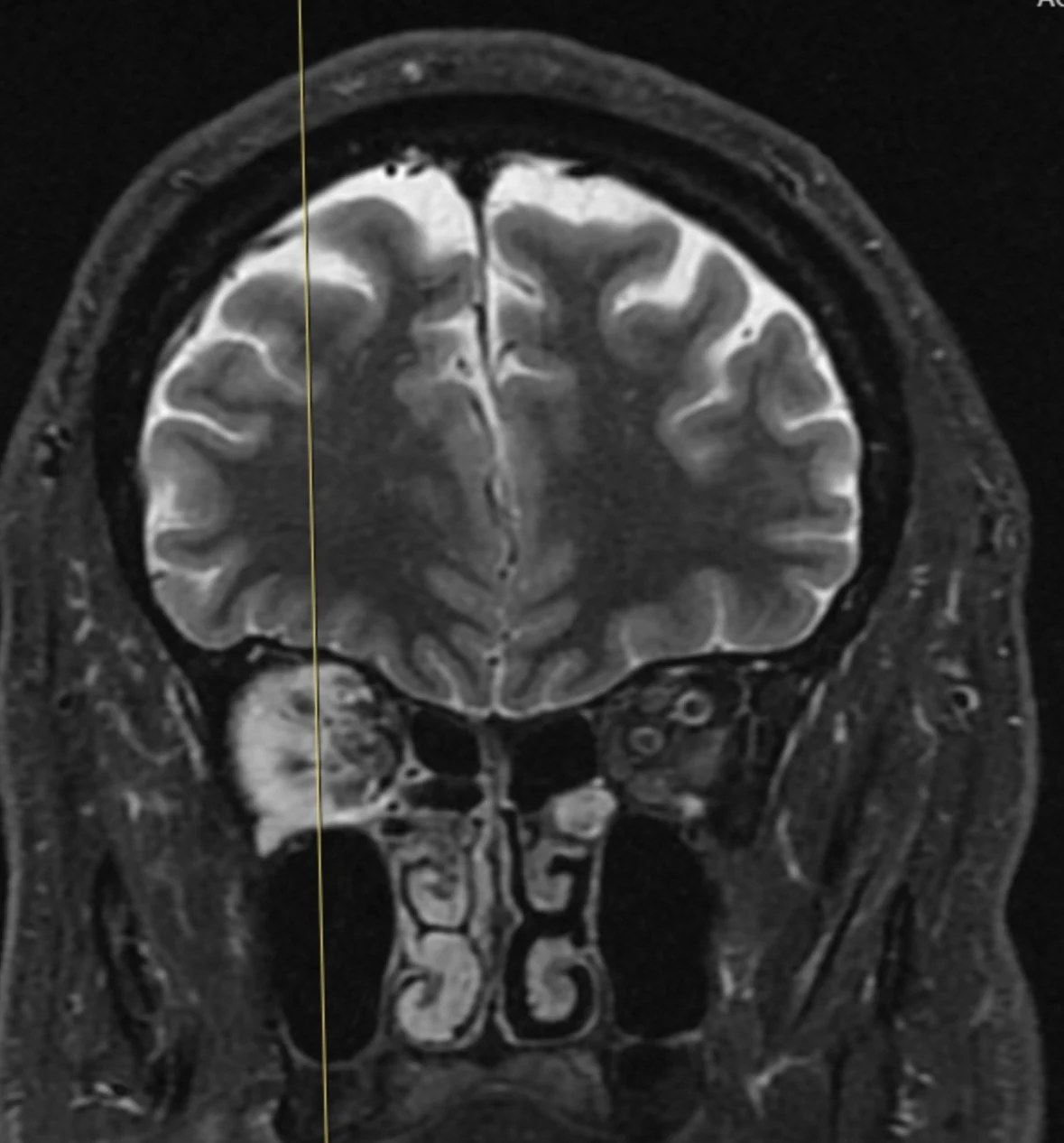 Adult Tumors 1 adult tumors 2