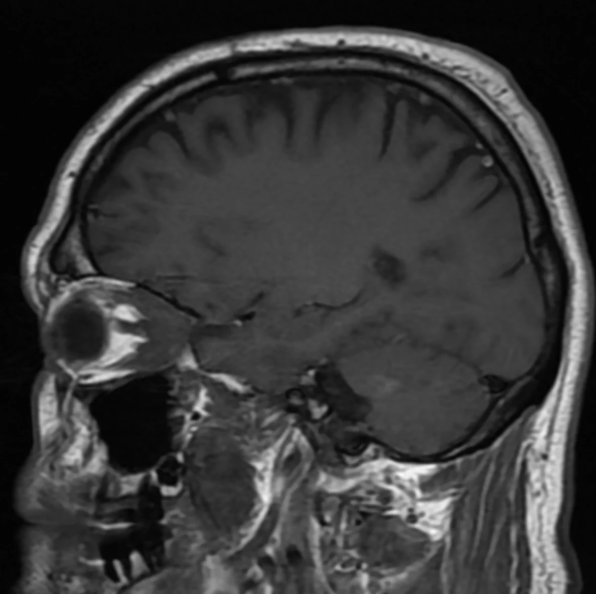 Adult Tumors 2 adult tumors