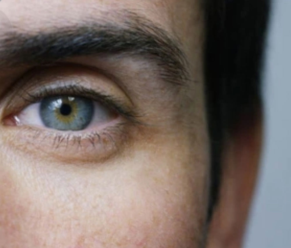 Lacrimal System Anatomy 1 eyelid patient