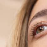 eyebrow lift