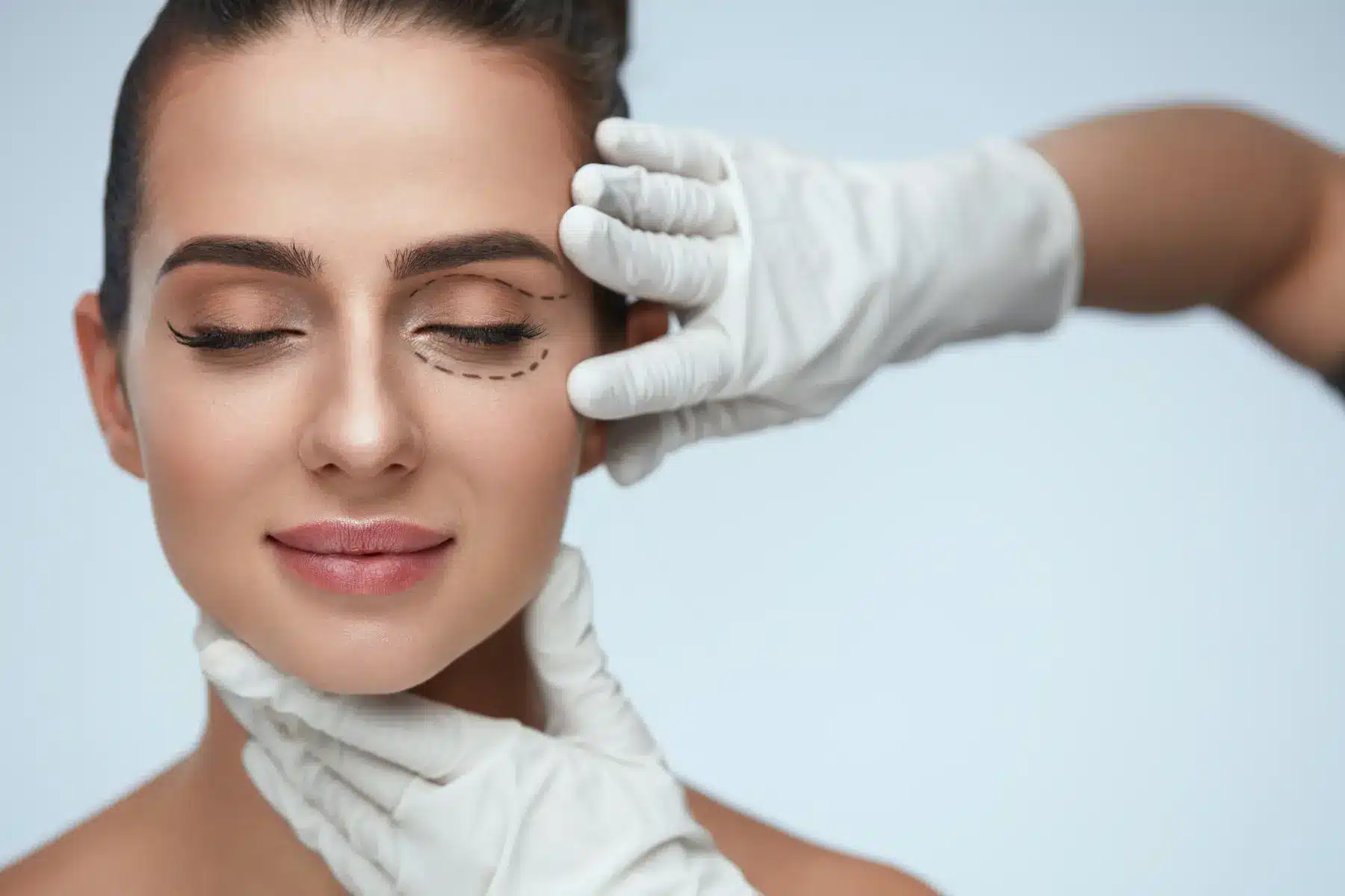 Brow Lift 3 Patient preparing for eyelid surgery